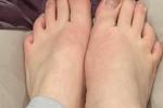 Post Dog Walk Feet Pics