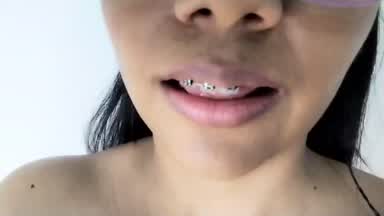 sexy braces♥