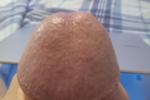 My head