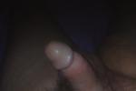 Jim dick