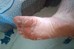 Feet