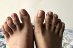 my feet