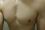 Pic1