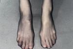feet