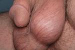 Sack
