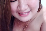 teaser