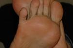Foot 2