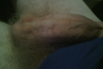 Thickness
