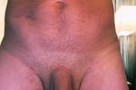 Full Frontal