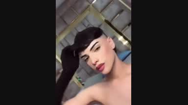 kiss