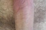 edging ?
