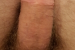 My large and thick