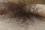 Hairy bush