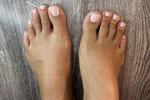 toenails