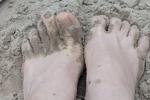 very dirty feet