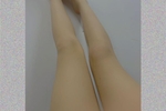 legs