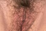 Hairy