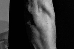 Arm