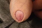 One of my holes