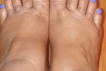 Feet
