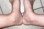 Flexed Toes Near My Bush