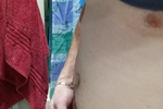 Me