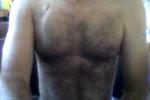 Hairy
