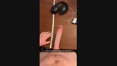Enlargement results