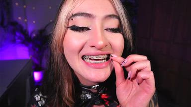 g҉i҉s҉e҉l҉ — Braces and sex enjoy😏♥️