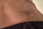 Abs
