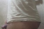 hot