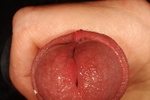 More Dick pictures