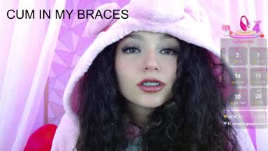 Admire my beautiful face and my braces