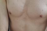 Chest and nipples