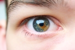 MyEye