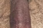 Medeni1