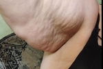 My armpits