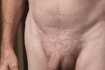 Me