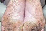 DirtyDirtyFEET