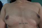 tits