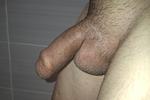 My  set