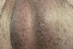 close up ball sack