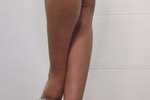legs