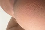 Holes