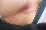 Tight hole