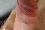 Beautiful foreskin