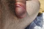 head cock at beach