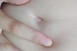 Belly