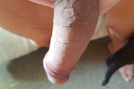 Ppp