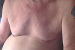 Tits pumping